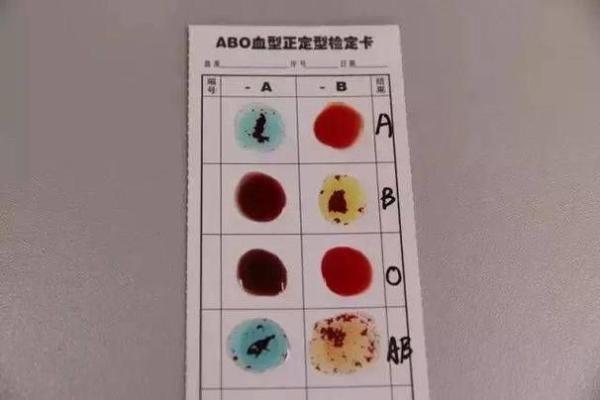 孕妇为什么要检查血型