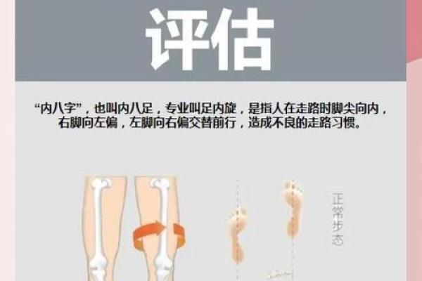 如何纠正内八字脚