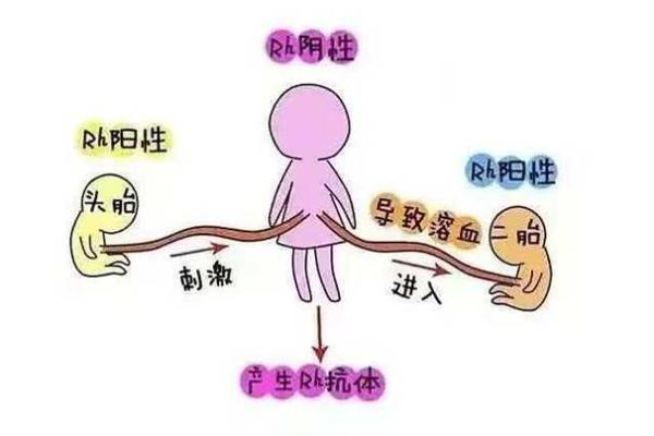 血型中rh阴性是什么意思