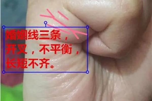 什么是“烦恼线”，手相烦恼线算命图解
